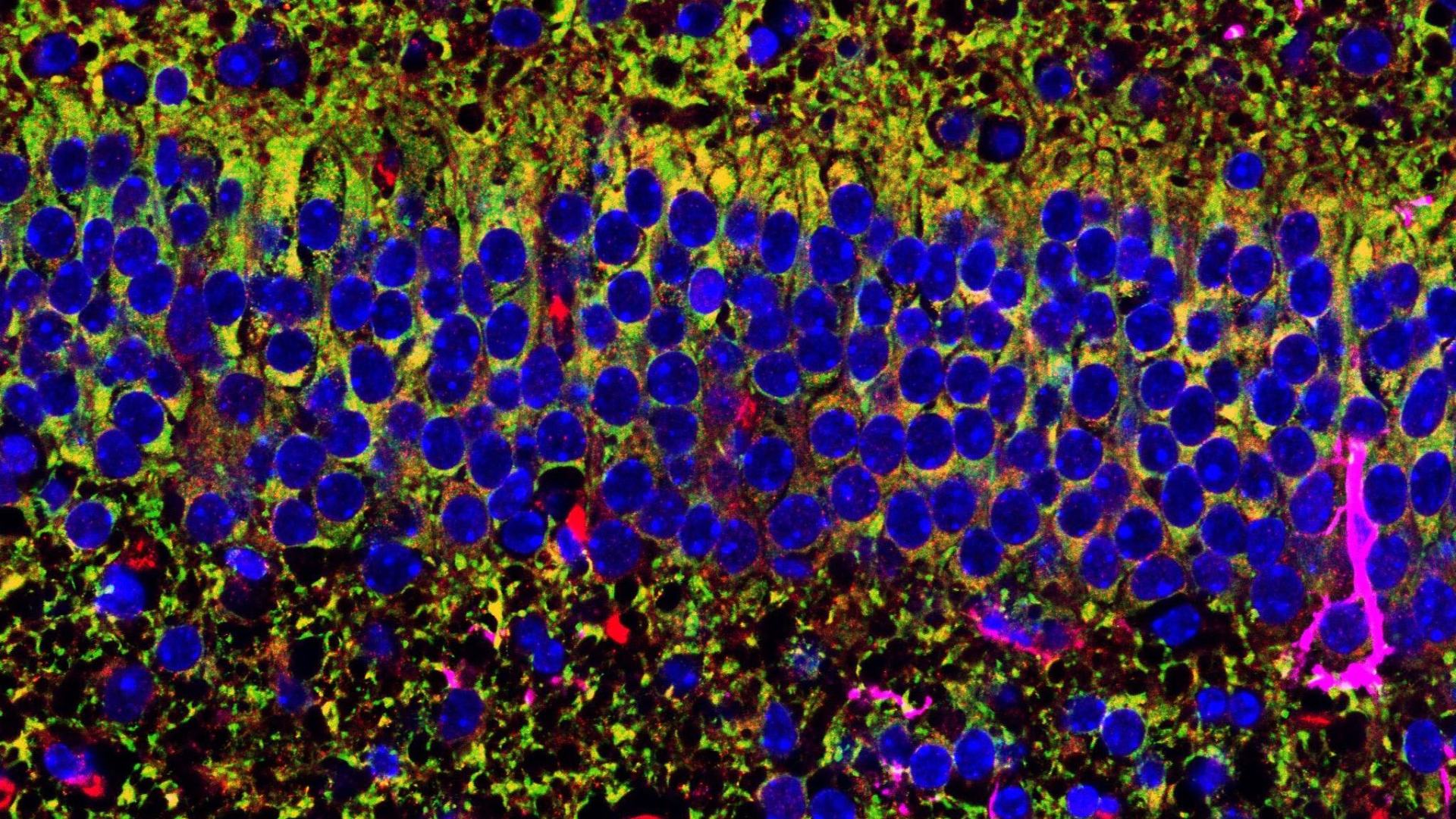 The immune system orchestrates neurodevelopment in the hippocampus
