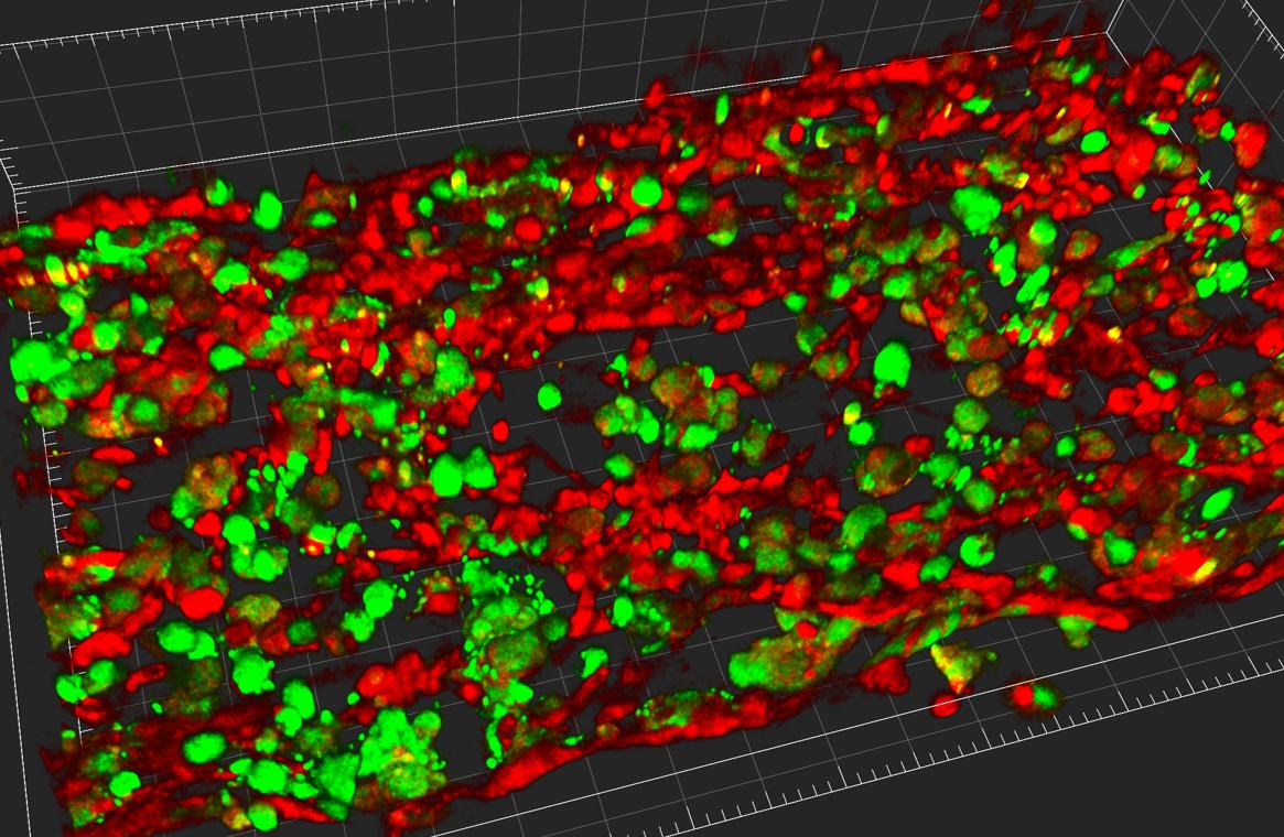 New organ-on-chip aims at accelerating research on cholangiocarcinoma